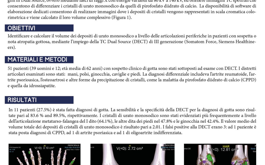 Artropatia gottosa: Ruolo della TC dual energy nella diagnosi