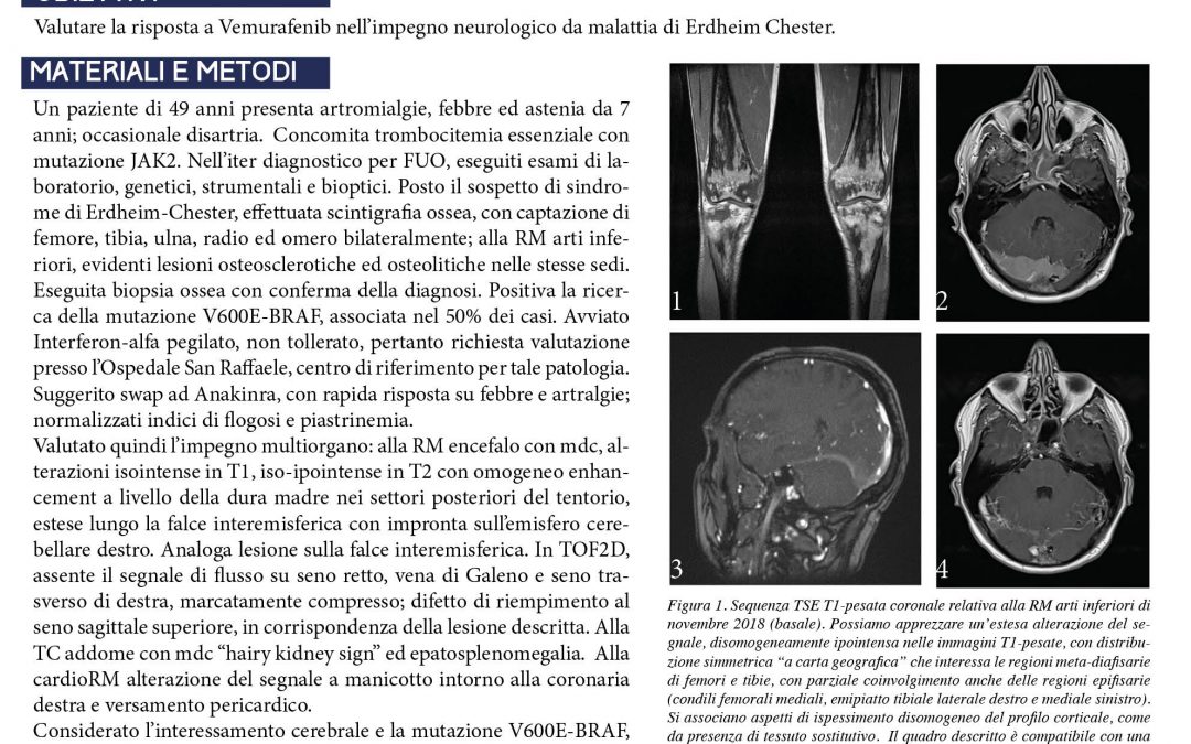 Sindrome di Erdheim-Chester ad impegno neurologico: rapida efficacia del trattamento con Vemurafenib