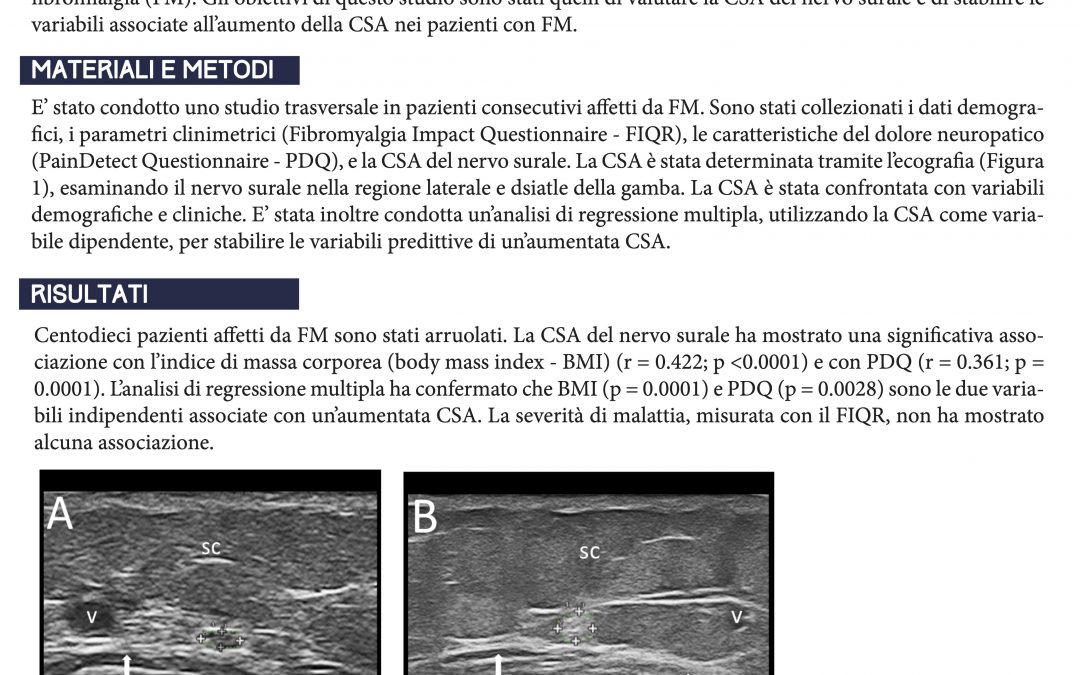 Le dimensioni del nervo surale in pazienti affetti da fibromialgia: studio sulle variabili predittive di un’aumentata area trasversa