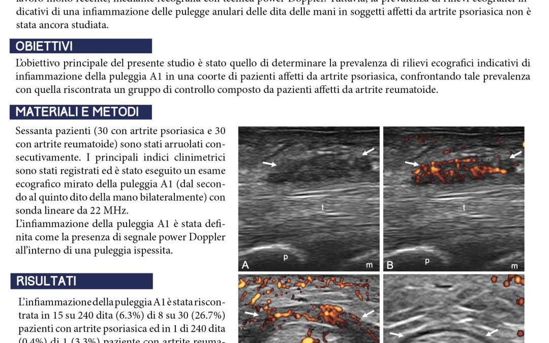 La valutazione ecografica della puleggia A1. Un nuovo target dell’infiammazione in corso di artrite psoriasica?