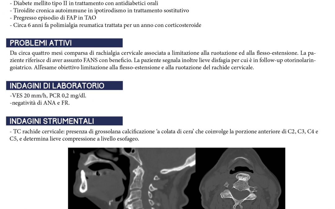 Caso clinico: Strano caso di disfagia